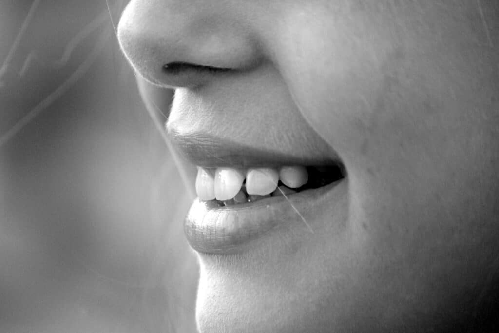 מדובר בקונכיות דקות בהתאמה אישית המכסות את המשטח הקדמי של השיניים כדי לשפר את המראה שלהן.

