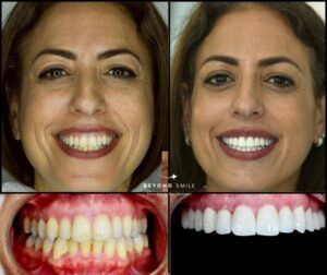 מדריך למניעת רשלנות טיפולי שיניים בטורקיה.