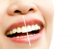 7 דרכים יעילות להלבנת שיניים